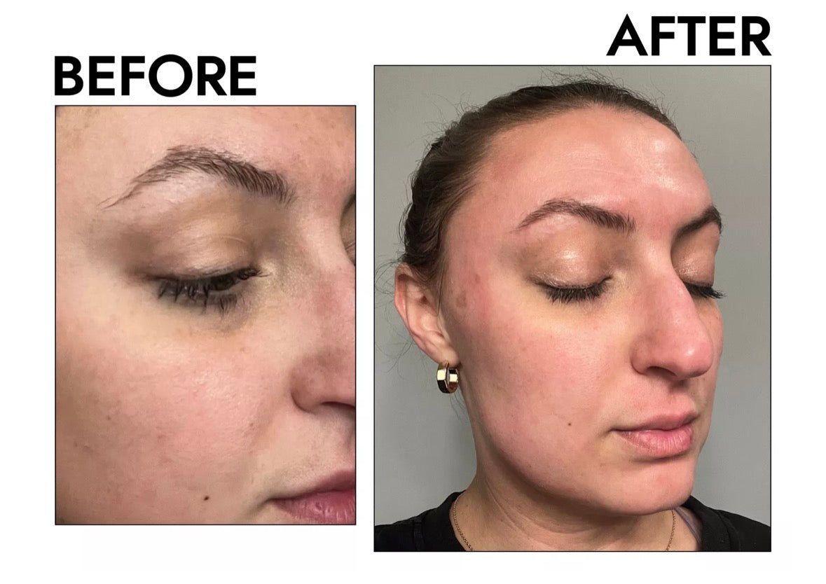 Professional Titanium ZGTS Derma Roller 192 Needles for Face Care and Hair-Loss Treatment CE Certificate Proved