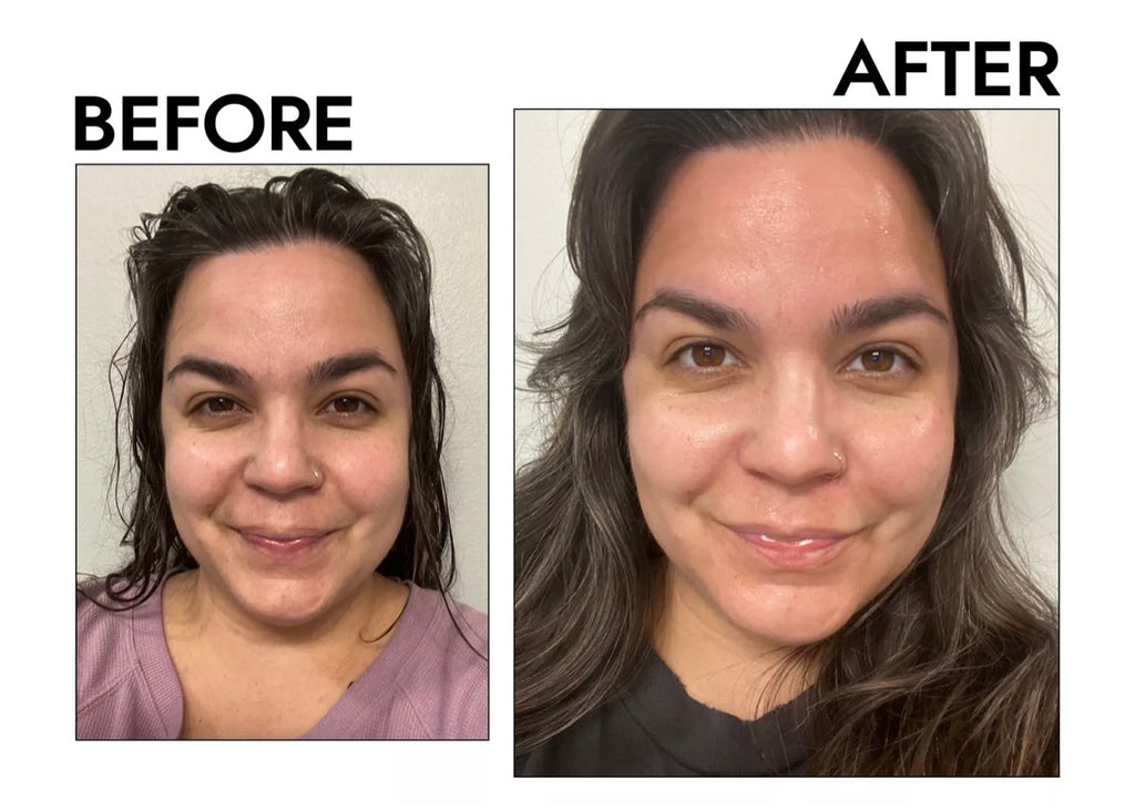 Professional Titanium ZGTS Derma Roller 192 Needles for Face Care and Hair-Loss Treatment CE Certificate Proved