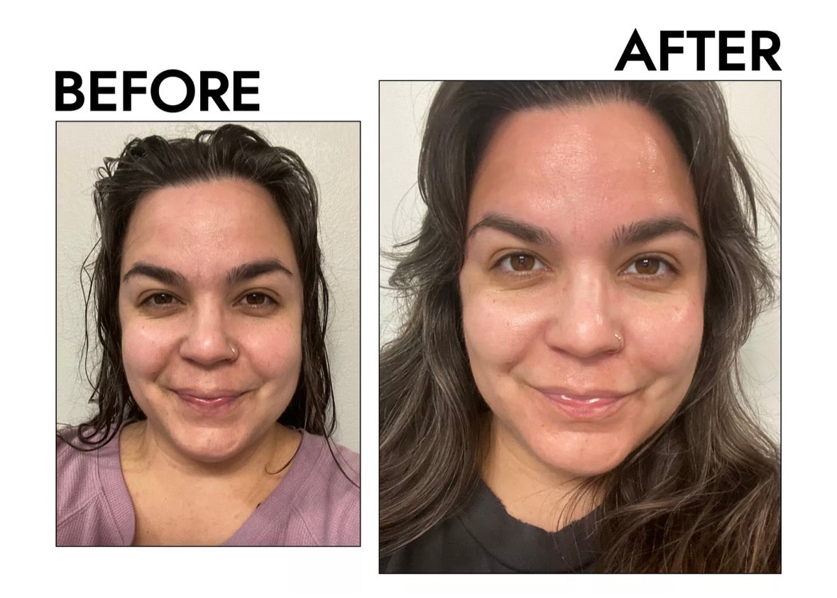 Professional Titanium ZGTS Derma Roller 192 Needles for Face Care and Hair-Loss Treatment CE Certificate Proved